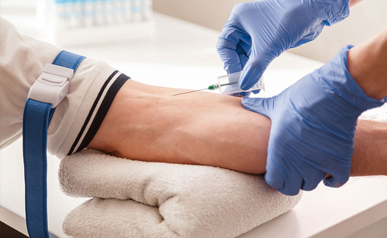 RJIR Vein Interventions
