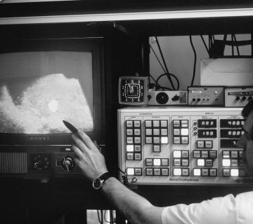 A photo of ultrasound