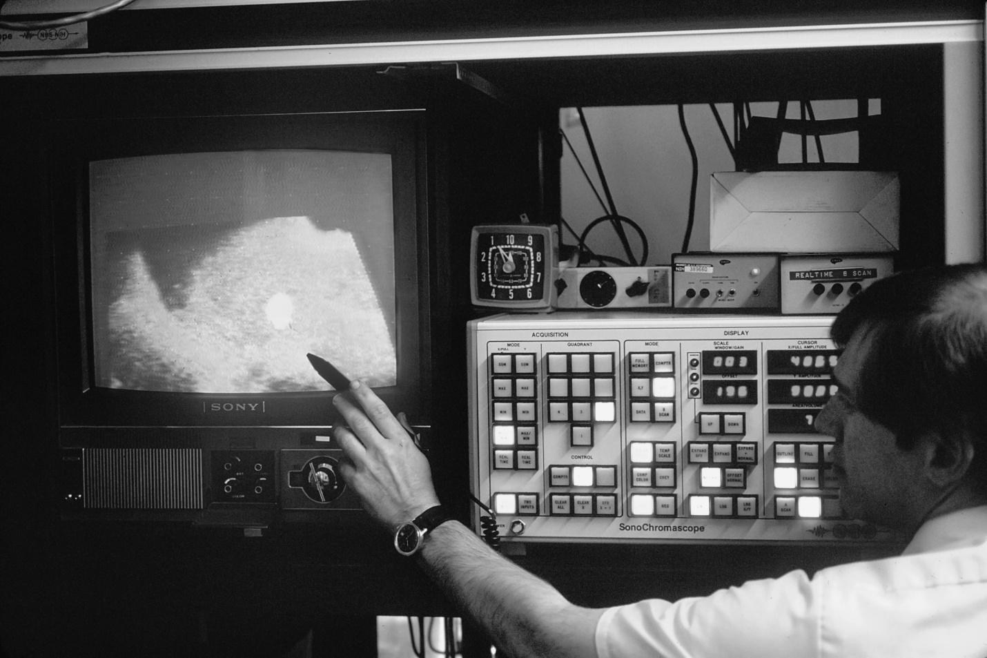 A photo of ultrasound