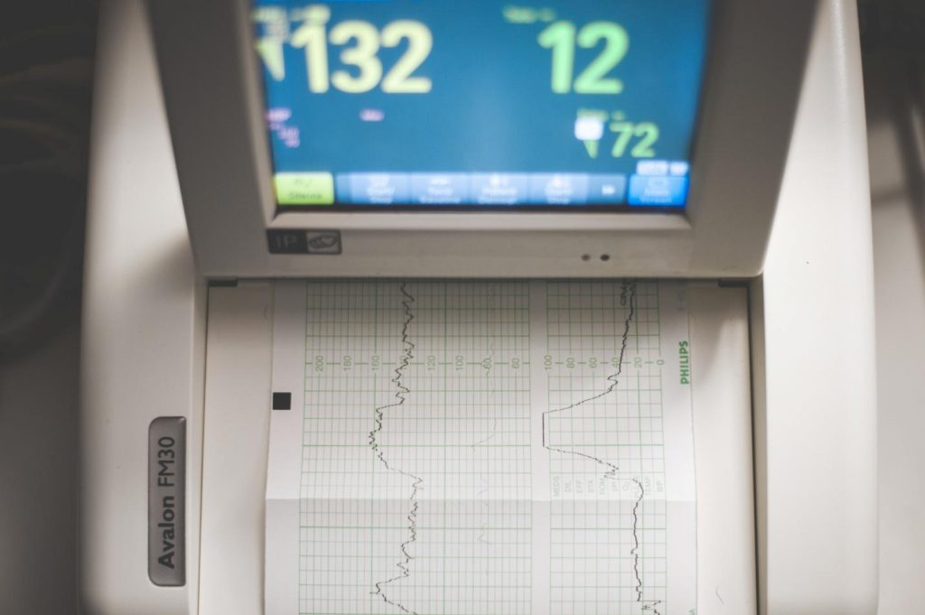 Intravascular ultrasound guide 