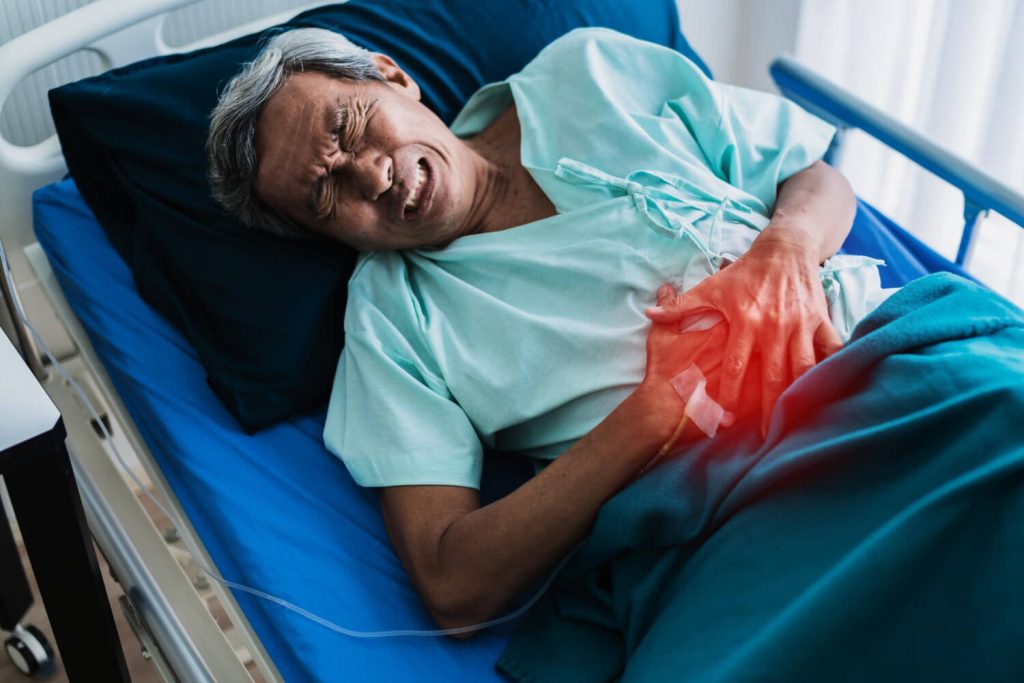 Hemorrhoid Treatment – Superior Rectal Artery Embolization